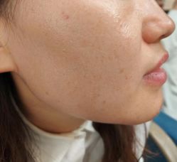 -北京美痣堂古方祛痣斑疣瘊