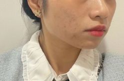 -美安心医美·美迪迈黄金微针·美拉美医疗美容