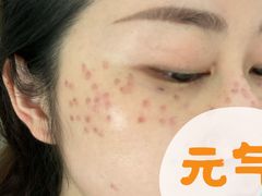 -中国医学科学院皮肤病医院