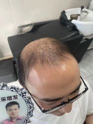 -唐风采假发补发定制