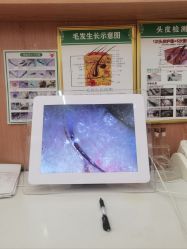 -侗秀养发•头疗