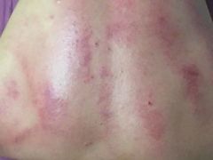-扶阳灸推拿养生馆