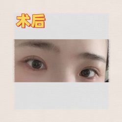 -素美医疗美容·西南眼鼻整形·修复基地