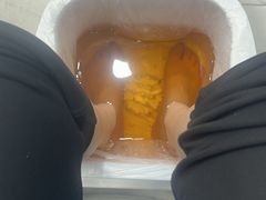 -Andrew指甲专科灰指甲·甲沟炎矫正·3D步态矫形鞋垫定制(浦三路店)