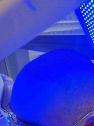 -碧莲盛·不剃发植发