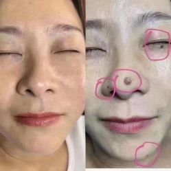 -清疣美疣·痣·斑净肤中心