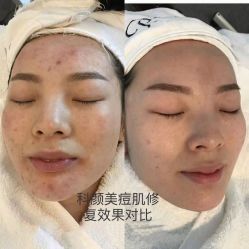 -美肤盾祛痘·问题肌头疗管理中心