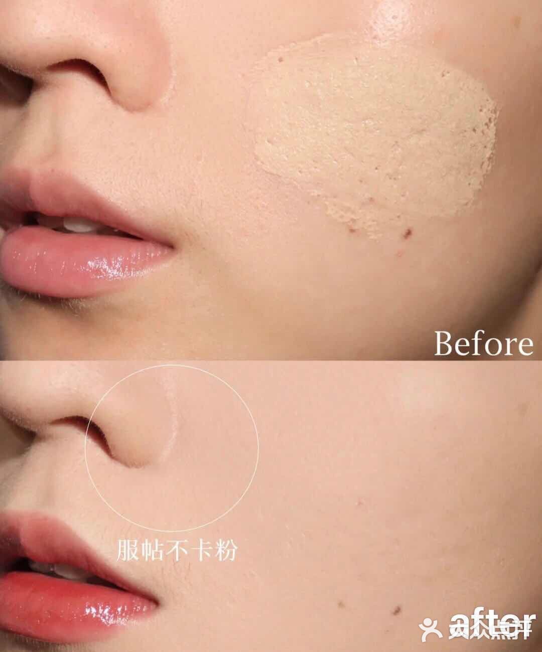 如果你是混油 干皮，混干皮
