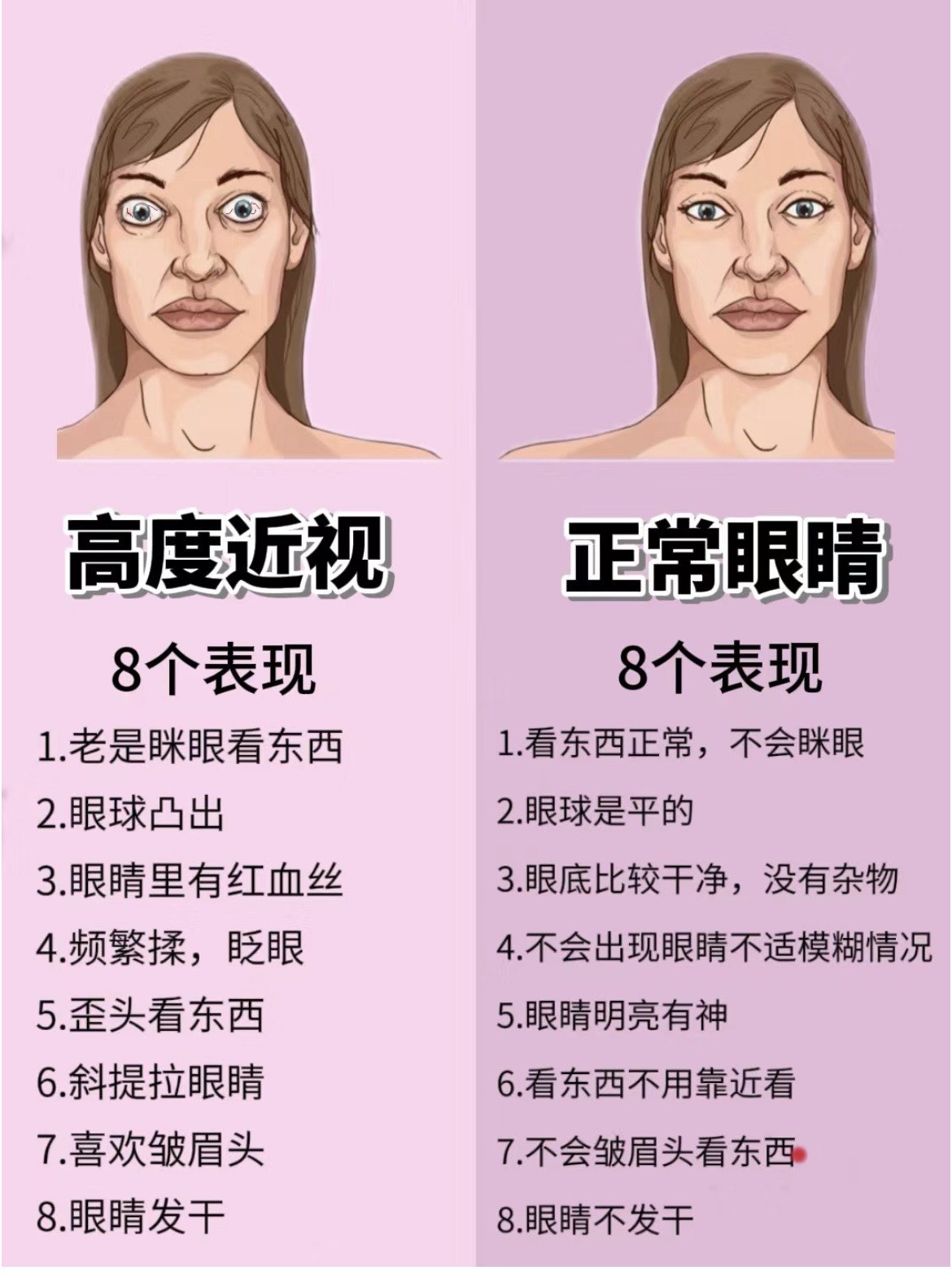 近视眼与正常眼图片