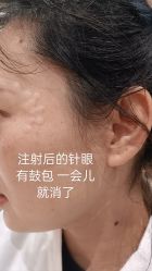 体验后-Yestar艺星医疗美容医院