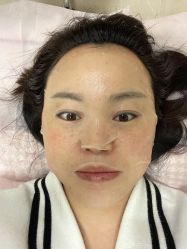 体验前-北京明德医院·医疗美容