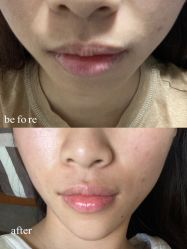 -新美荟医美·专注面部美学抗衰