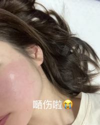 -宥莉·ULLY 痘敏肌•科技皮肤管理中心