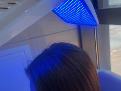 -碧莲盛·不剃发植发