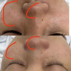 点击看大图 -凡碧诗毛孔清洁收细