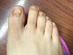 -新甲连锁灰指甲·甲沟炎·鸡眼(黑龙江路店)