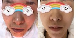 -康美贞·痘肌养护管理中心