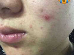 -苗方清颜痘肌研究所