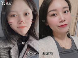 -Yestar艺星医疗美容医院