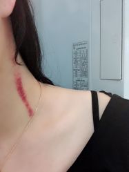 -安那般那皮肤年轻化ANAPANA