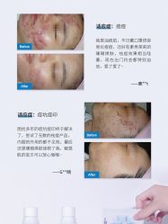 -苗方清颜痘肌研究所