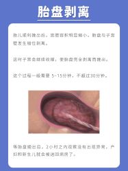 点击看大图 -杭州贝瑞斯美华妇儿医院·早孕·产检·儿科