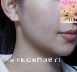 -深圳艺星医疗美容医院