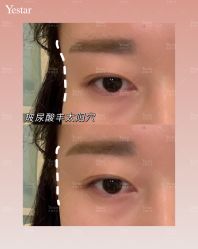 -Yestar艺星医疗美容医院