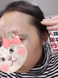 体验前-美莱医学美容医院