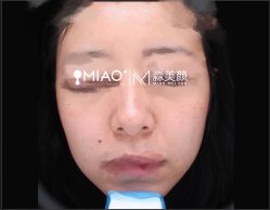 -韩国淼美颜皮肤管理官方直营店