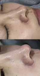 -SKIN79皮肤管理中心