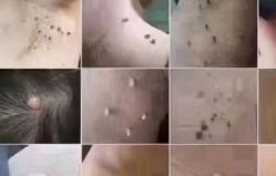 点击看大图 -玫莉蔻皮肤管理中心