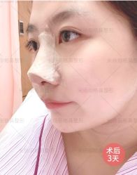 体验后-北京米扬丽格医疗美容·联合丽格鼻整形中心