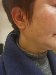 -四川米兰柏羽医学美容医院