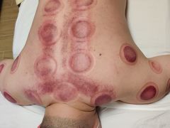 -安琪盲人按摩调理草本熏蒸馆(风和日丽店)