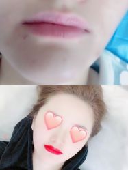 点击看大图 -西施无菌半永久纹绣眉眼影唇轻增发纹发际线