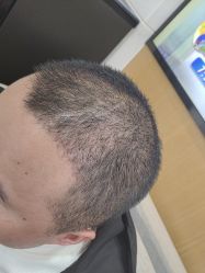 -雍禾植发全国连锁