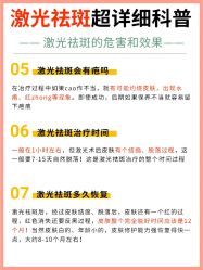 -蕾特恩专业祛痘国际连锁