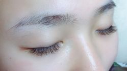 点击看大图 -初樱科技美学问题肌修复中心