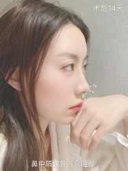 -北京米扬丽格医疗美容·联合丽格鼻整形中心