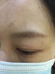 -郡艺医疗美容·微整·眼鼻吸脂