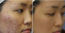 -SKINIST丽铂医疗美容