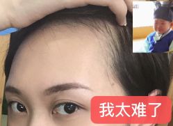-OnFaer.纹眉半永久无创洗眉