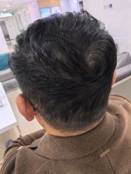 体验后-雍禾植发全国连锁