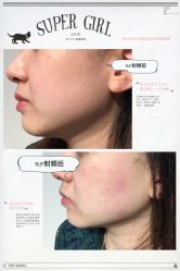 光SPA小V脸-光SPA科技美肤