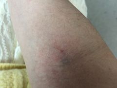 -武汉大学附属爱尔眼科医院(湖北总院)