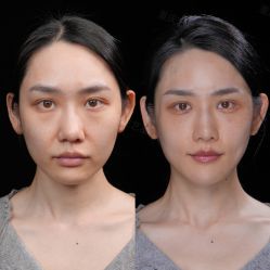 -Yestar重庆艺星医疗美容医院