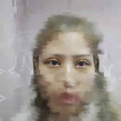 点击看大图 体验后-郑州米兰柏羽集美医疗美容医院