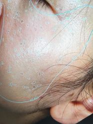 -苑苑vbeauty科技美容SPA