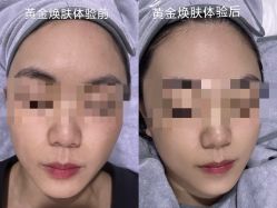 点击看大图 -SKIN79皮肤管理中心